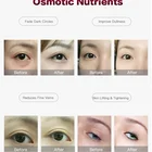 Eye Lifting Beauty Radiofrequency Monopolar Rf Skin Tighten Machine
