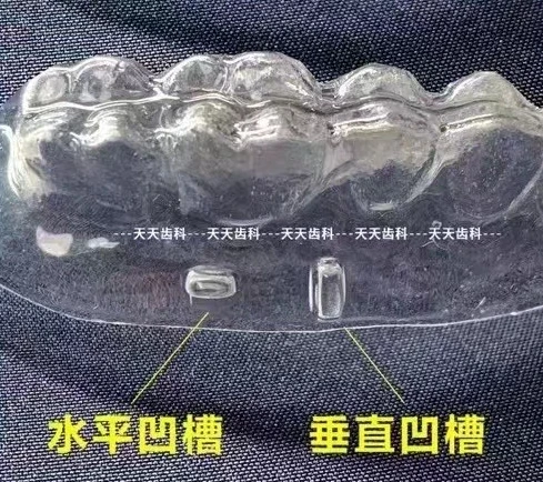 aligner 1.jpg