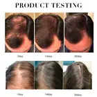 Natural Hair Growth Essential Natural Plant Extract Ginger Germinal Oil Hair Growth Essential Oil Hair Loss Treatment
