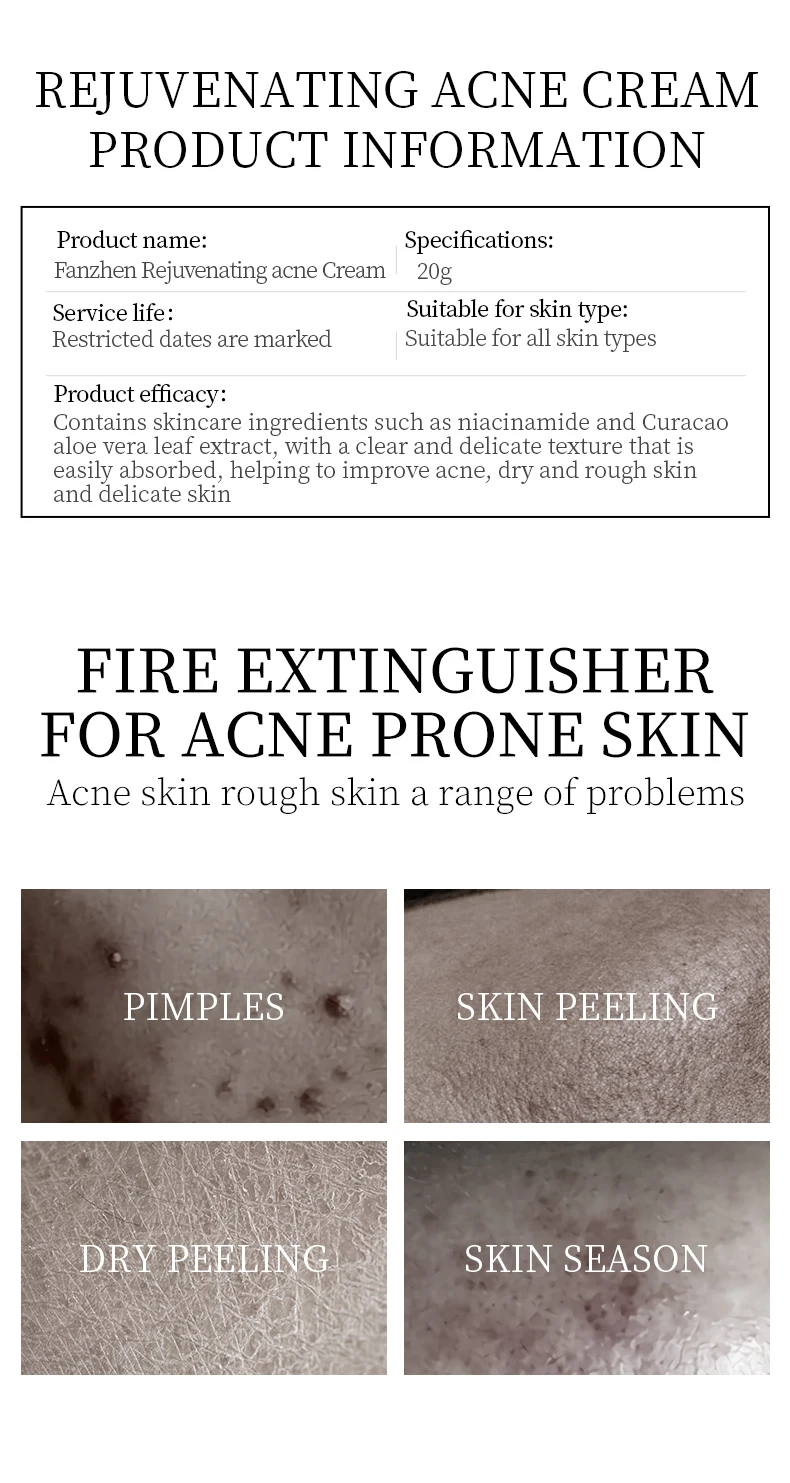 odm veze removing beverage cream pimple acne moisturizer face whitening cream-3