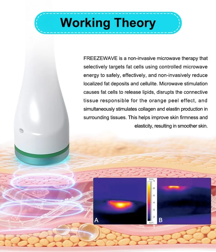 FREEZEWAVE Non-Invasive Body Contouring and Slimming Machine 4 <h2>Professional Microwave Fat Reduction System for Clinics, Med Spas & Aesthetic Centers</h2> Discover the professional FREEZEWAVE body contouring machine featuring 2.45GHz microwave technology, fat reduction, cellulite improvement, skin tightening, and non-invasive body sculpting for aesthetic clinics and salons. FREEZEWAVE Non-Invasive Body Contouring and Slimming Machine