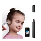 Iphone Cheap And Fine Digital Ear Cleaning Endoscope Electronic Otoscope Support Ios Iphone And Android System