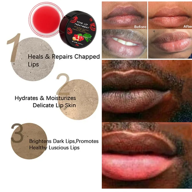 Pink Lip Treatment Lightening Bleaching Cream To Remove Dark Smoke Lips