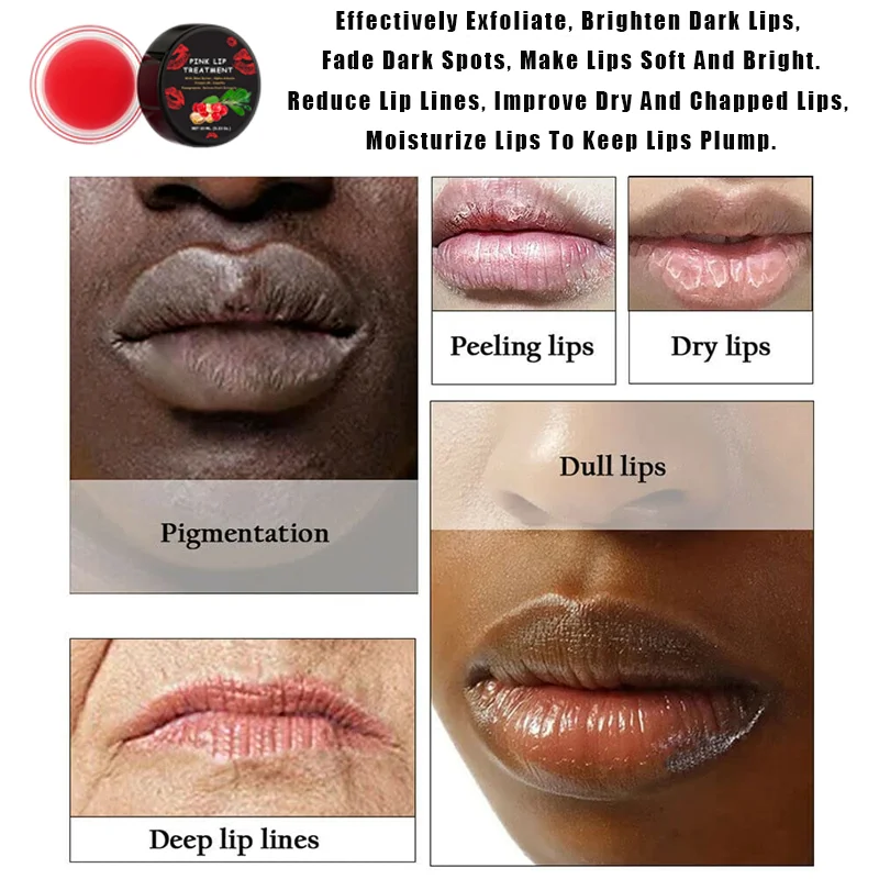 Pink Lip Treatment Lightening Bleaching Cream To Remove Dark Smoke Lips