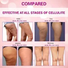 Cream Gel Weight Loss Hot Slimming Cream Fat Burn Gel Slimming Cream Private Label
