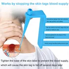 Care Lescolton Factory Wart Remover Acne Pimple Mole Treatments Face Skin Care Tool Removing Skin Tags