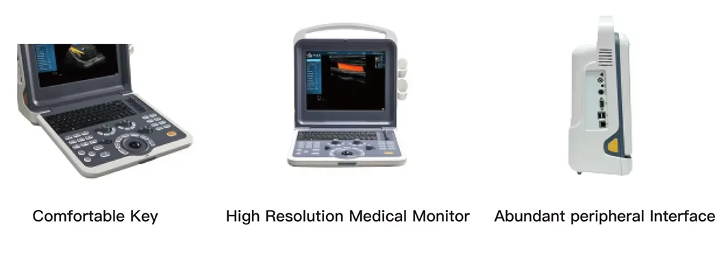 Portable PC Platform Color Full Digital Ultra Sound Scan Portable Laptop Ultrasound Machine details