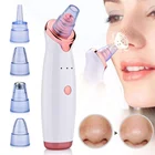 Remover Pore Cleaner 5 In 1 USB Rechargeable Electric Facial Pore Cleaner Blackhead Remover Vacuum