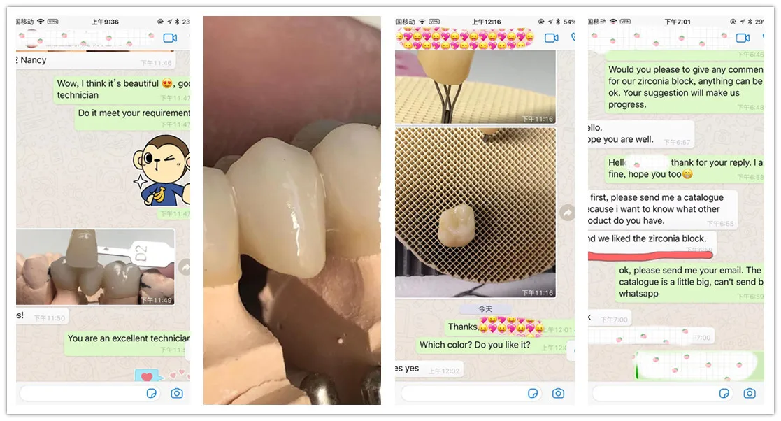 Yucera Dental Ceramic Cad Cam ST Color Zirconia Block Open System 98mm with CE and ISO