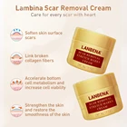 Removal Stretch Mark Cream For Pregnancy Scar Removal Stretch Marks Scar Removal Cream Maternity Treatment