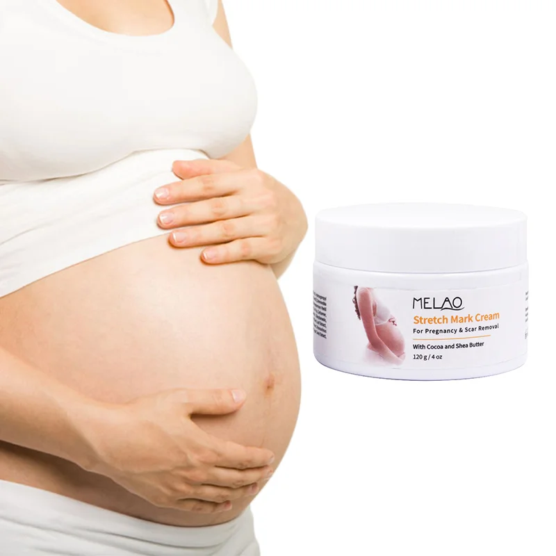 best belly stretch mark cream