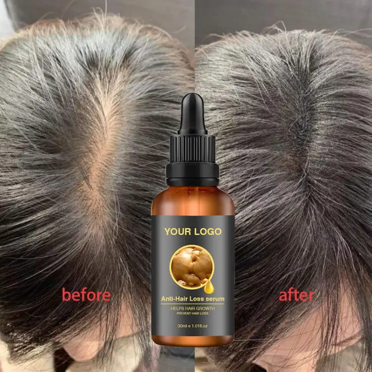 Private Label Best Natural Organic Oil Essential Biotin Serum Hair Growth  Oil At Home For Men And Women - Buy Hair Serum,Hair Regrowth,Treatment For  Bald Hair Product on 