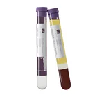 Prp Gel OEM Medical Consumables Selling Sodium Citrate Gel Testing 12ML PRP Tube