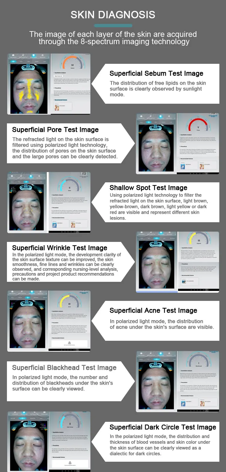 Professional Skin Analysis Machine AI 3D Facial Skin Scanner for Sale 12 Upgrade your consultation accuracy with our AI Skin Analysis Machine. Featuring 3D imaging, multi-spectrum detection, and intelligent reports for dermatology clinics, med spas, and aesthetic centers. Professional Skin Analysis Machine AI 3D Facial Skin Scanner for Sale