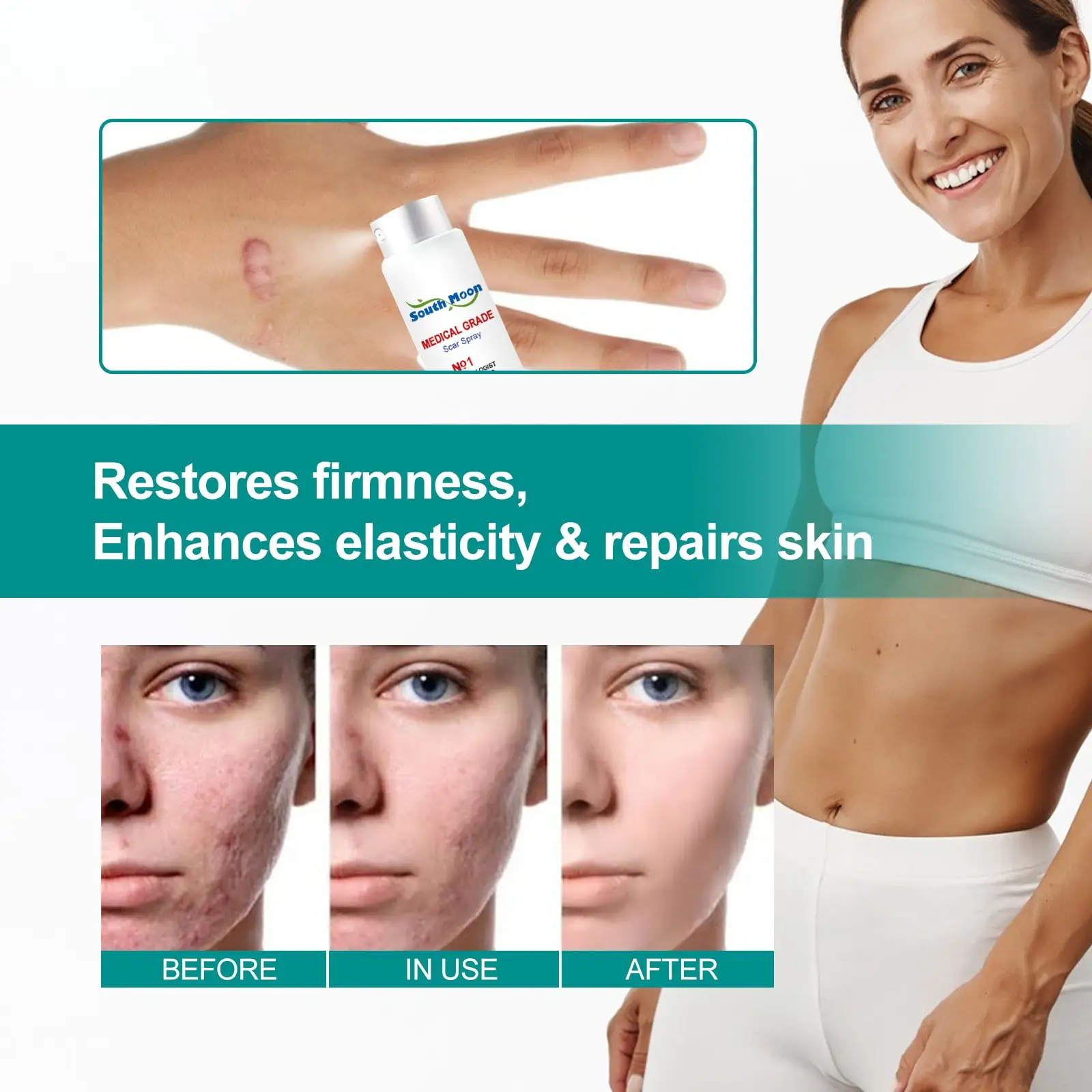 South Moon Scar Spray Cesarean Hyperplastic Contracture Burn Acne Surgical Scars Stretch Mark Keloid Treatment Liquid