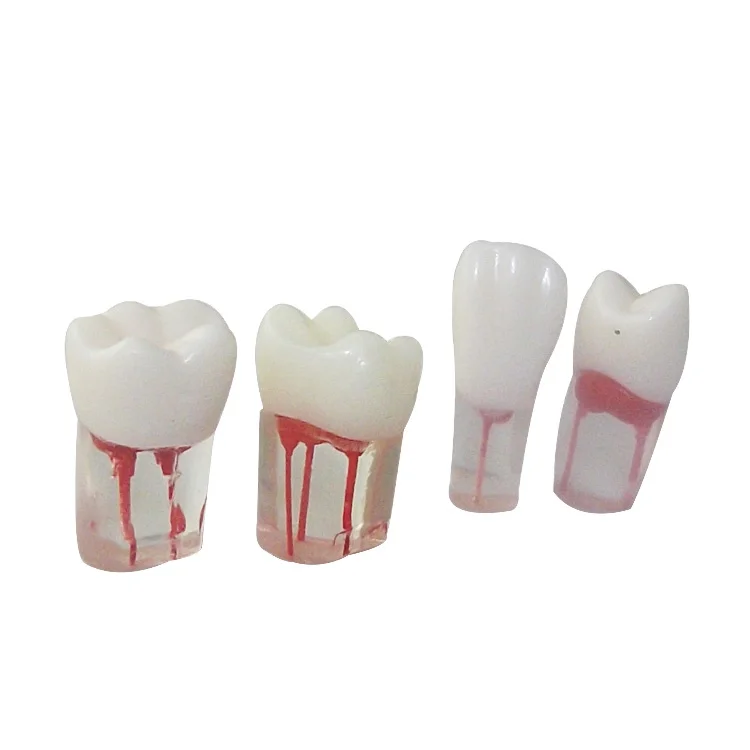 dental tooth root medullary pulp cavity clear resin canal model