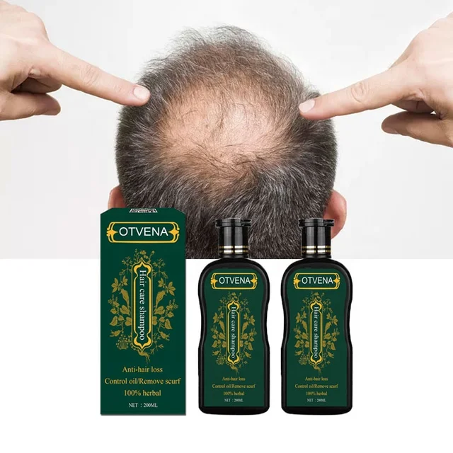 15 Years GMP MSDS Factory Offer Organic Hair Shampoo For Thinning Hair