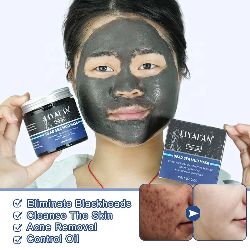 hjælper Bløde Plakater Most Effective Homemade Blackhead Removal Masks Be Beautiful India | Dead  Sea Mud Blackhead Remover Large Pores Cleansing Purifying Face Mask T Zone  Nose Black Dots Peel Off Mask Skincare Products 