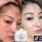 Cream Face Spot Removal Cream Skincare Spots Freckle Removal Cream Skin Whitening Face Cream