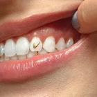 Gold Gem Gems Goldgold Tooth Decoration Custom Solid Gold Tooth Gem Jewelry 14k Gold Tooth Gems Gold