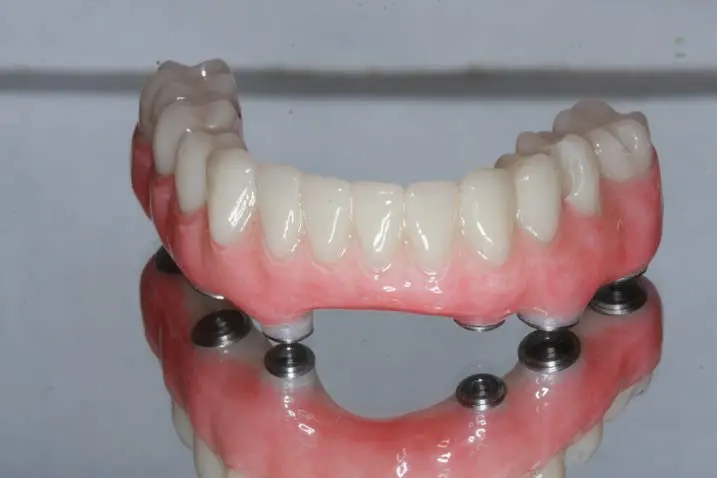 Yucera Optimal Transparency Dental Monolayer PMMA for Precision and Natural-Looking Prosthetics