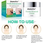 Acne Cream Private Label Acne Treatment Instant Facial Care Freckle Mark Removal Cream