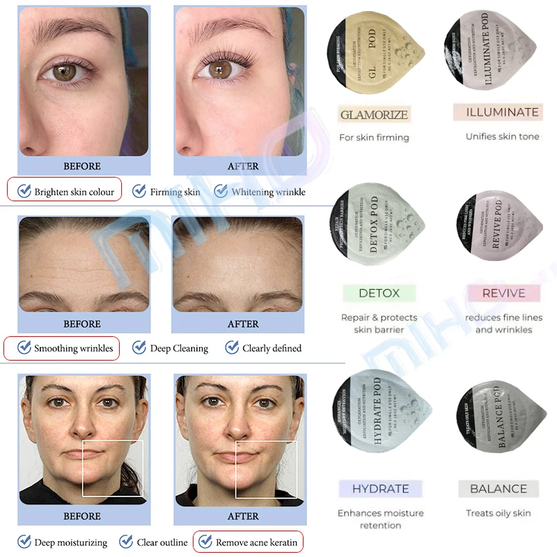 Professional CO2 Oxygen Facial Machine for Home Use with 2 Years Warranty and OEM/ODM Service