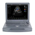 3D/4D Ultrasound Scanner Laptop Ultrasound Scanner Color Doppler Portable Ultrasound