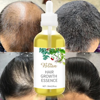 Custom private label The hair care serum makes hair thicker and visibly longer specially designed for thinning and loss