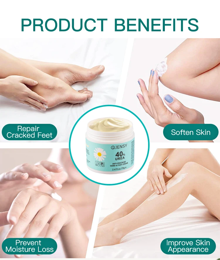 Foot care cream for cracked heels exfoliating anti crack peeling dead skin removal foot repair whitening urea foot cream