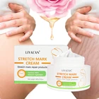 Natural Marks Mark Private Label Natural Anti Vergeture Strech Marks Repair Scar Stretch Mark Removal Cream