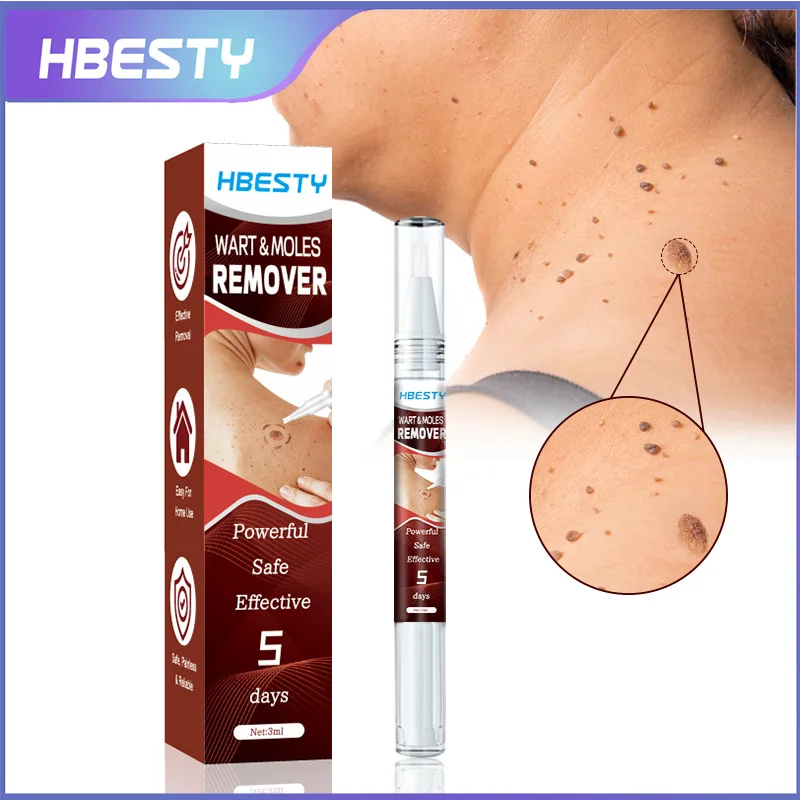 OEM Wart & Moles Cream for Improving Skin Problem