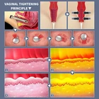 Fractional Laser Co2 Fractional Rf Fractional Co2 Laser Vagina Tightener