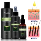 Hair Growth Serum OEM Men Women Natural Biotin Essential Oil Hair Growth Serum