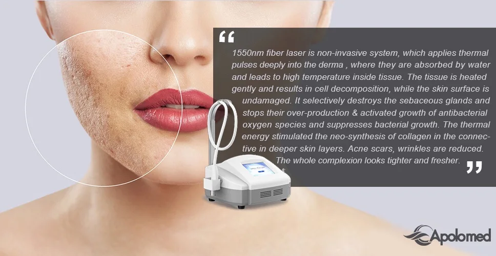 1550nm Erbium Yag Laser Machine manufacture