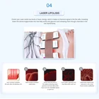 Taibo Cavitation Rf Lipolaser Radiofrequency Weight Loss Machine