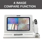 Beauty Meicet Beauty Skin Hair Analysis Hair Follicle Detector Wireless WiFi Skin Scalp Analyzer Machine