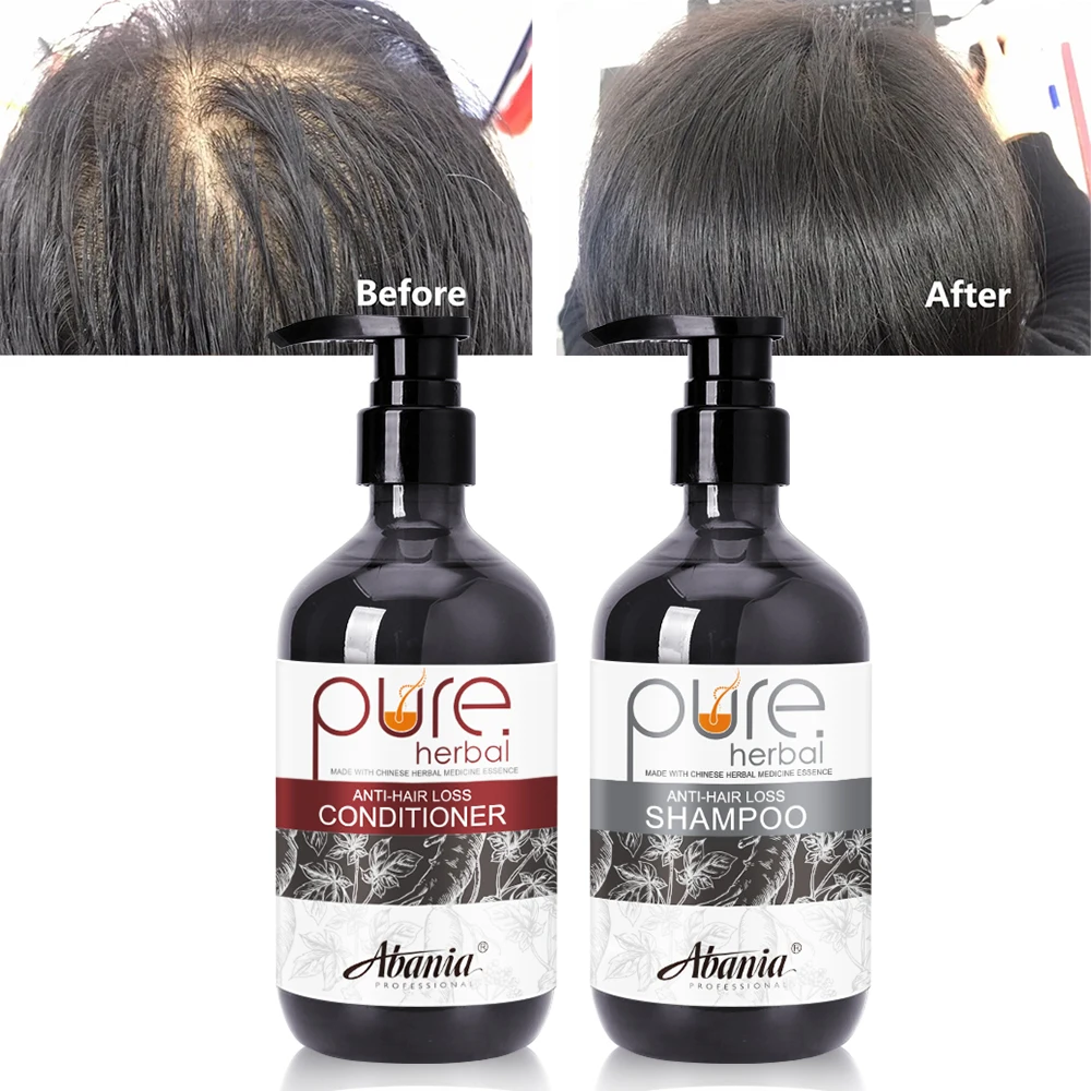 2022 New Arrivals anti-hair loss shampoo and conditioner with Chinese herbal natural plant extract ginger juice