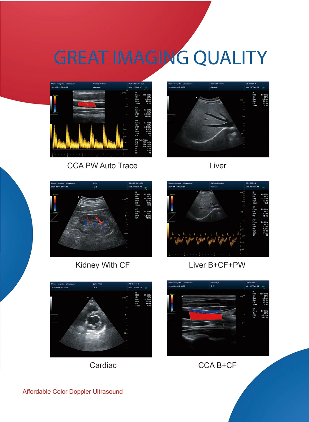 Contec Cms1700b Abdominal Obstetric Urology Cardiac Pediatric