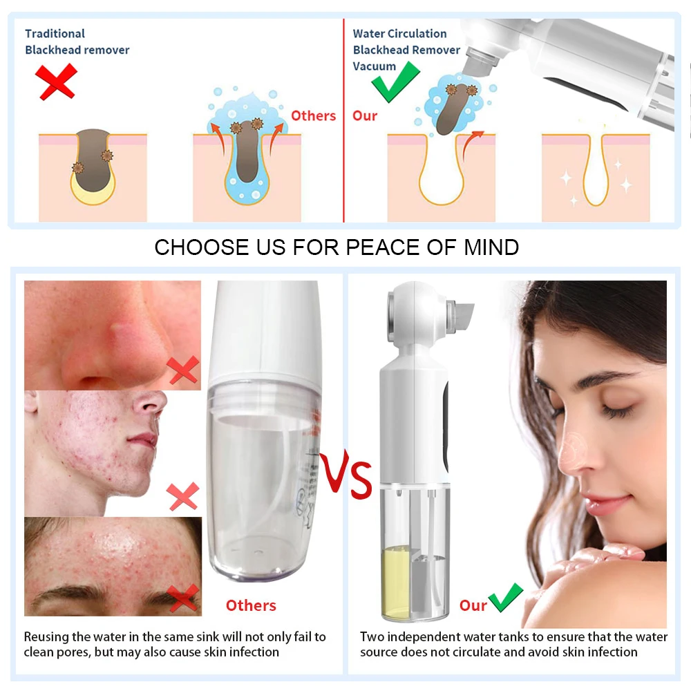 Facial Heating Deep Cleansing Micro Bubble Beauty Machine Blackhead Remover Pore Vacuum Acne Extractor