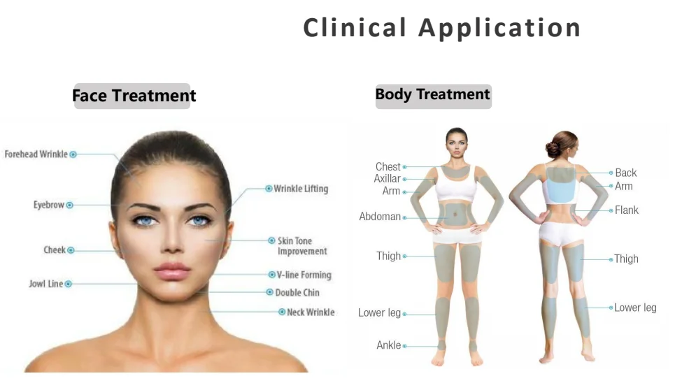 7D HIFU Machine – Face Lifting & Body Slimming Device for Salons 10 TECHNICAL SPECIFICATIONS <ul> <li>Power: 500W</li> <li>Voltage: 100V/110V/220V</li> <li>Energy output: 0.1J-3.0J</li> <li>Screen Size: 10.4 inches touch screen</li> <li>HIfu Cartridges: 1.5mm/2.0mm/3.0mm/4.5mm/6.0mm/9.0mm/13.0mm</li> <li>Cartridge Shots: 20,000 / 30,000 shots</li> <li>Dot distance: 1-2mm</li> <li>Frequency: 2MHz / 4MHz / 7MHz</li> <li><span class="attr-name J-attr-name" title="HIFU Length" data-spm-anchor-id="a2700.wholesale.0.i34.67a066f4kJ6h3j">HIFU Length: </span>5-25mm Adjustable</li> <li>Package Size: 57*51*131CM</li> <li>Package Weight: 36 kg</li> <li>ReturnPolicy: <b class="magic-5"><span style="color: #2196ed;">30 Days Money back guarantee</span></b> <a href="http://skintechx.com/refund_returns" data-sm="true">Return Policy</a></li> <li>ShippingDetails: <b class="magic-5"><span style="color: #2196ed;">FREE SHIPPING fast delivery</span></b> <a href="https://skintechx.com/shipping-policy" data-sm="true">Shipping policy</a></li> </ul> 7D HIFU Machine – Face Lifting & Body Slimming Device for Salons