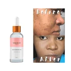 Essential Fast Shipping Glow It All Private Label Vegan Jojoba Face Oils Bulk Rose Facial Essential Oil Sample