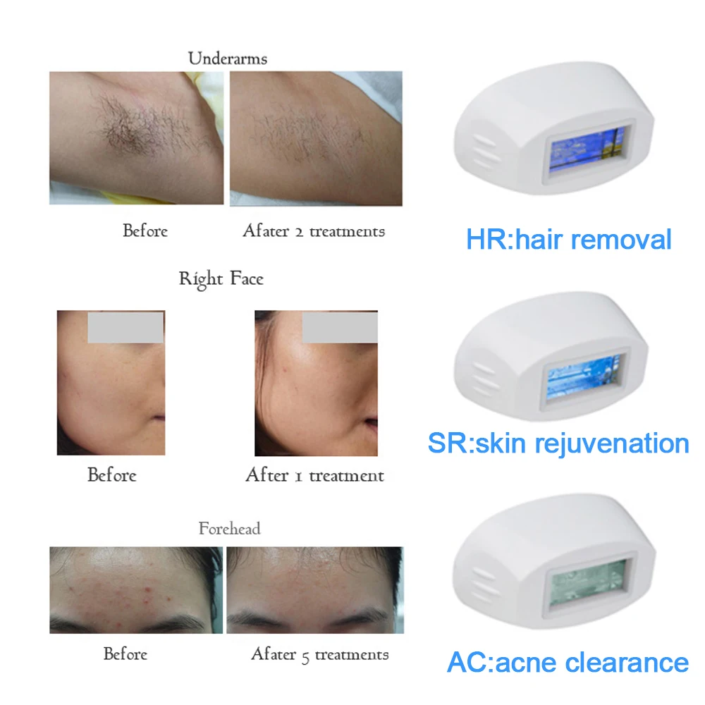 Mlay T3 Portable Home Use IPL Laser Hair Removal Device 500000 Shots Features Permanent Hair Removal Face Lift Free Shipping
