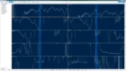 Recorder 12 Channel Holter ECG Recorder Analysis Workstation