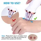 Remover Cleaners Blackhead Remover Kit Kits 7Pcs Pimples Comedone Extractors Cleaners