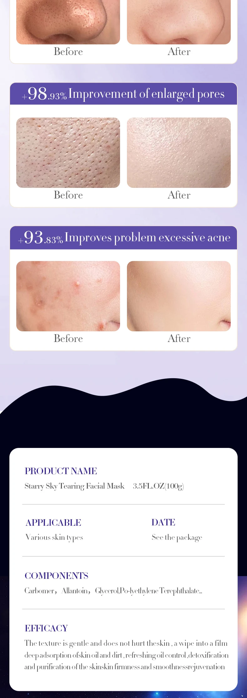 product 100g sadoer starry sky face and body mask for blackhead acne removal deep cleaning multi style adsorption peel off face mask-15