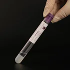 Virtuose Prp Tubes Virtuose Acd And Gel Injection 9ml PRP Tube For Face Beauty