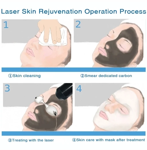 gel laser  (7).jpg