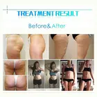 Ultrasound Cavitation Vacuum Body Shaping Slimming Machine Weight Loss Electronic Body Shaper Distributor