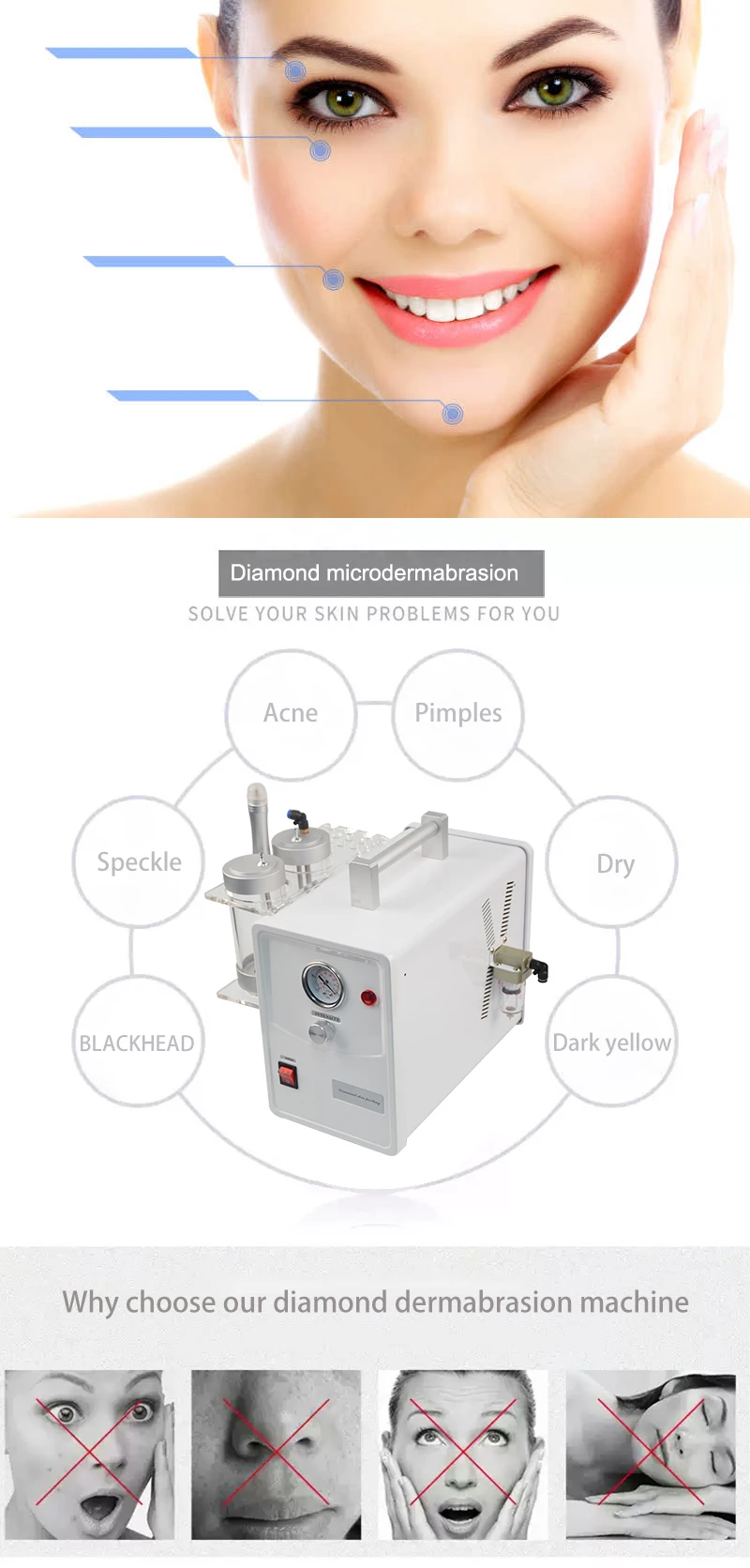 Professional Crystal & Diamond Microdermabrasion Machine 2-in-1 6 Discover the professional 2-in-1 Crystal & Diamond Microdermabrasion Machine for advanced skin resurfacing, exfoliation, acne scar treatment, pore refinement, and facial rejuvenation. Ideal for beauty salons, med spas, aesthetic clinics, and skincare professionals. Professional Crystal & Diamond Microdermabrasion Machine 2-in-1
